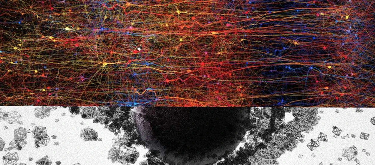 Naukowcy obserwują pracę mózgu w 11 wymiarach. To może zupełnie zmienić nasze postrzeganie umysłu