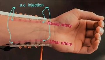 Koniec Holtera? Grafenowe „tatuaże” mają umożliwić stały pomiar ciśnienia krwi