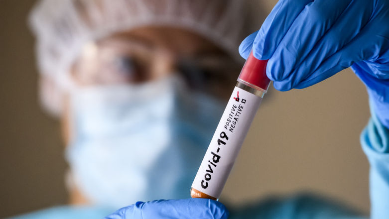 COVID-19 powoduje autodestrukcję mózgu. Naukowcy coraz bliżej rozwiązania zagadki „mgły mózgowej"