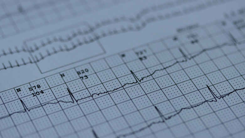 EKG w smartwatchu – rewolucja czy marketingowa ściema?