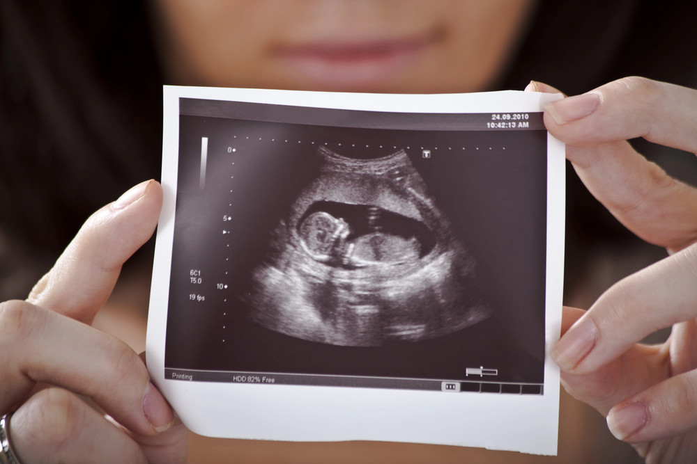 Smart opaska dla nienarodzonego bobasa. Może uratować życie matki